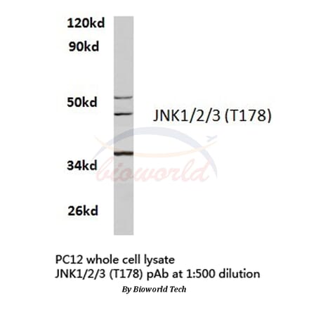 Anti-JNK1/2/3 (T178) Antibody from Bioworld Technology (BS3630) - Antibodies.com