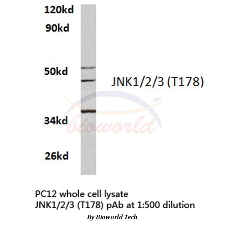 Anti-JNK1/2/3 (T178) Antibody from Bioworld Technology (BS3630) - Antibodies.com
