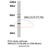Anti-JNK1/2/3 (T178) Antibody from Bioworld Technology (BS3630) - Antibodies.com