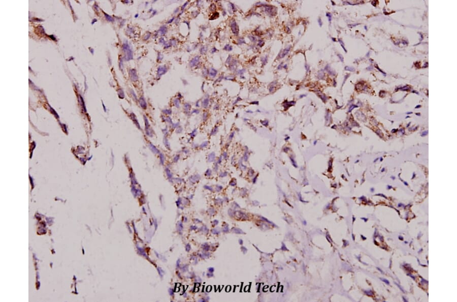 Anti-JNK1/2/3 (T178) Antibody from Bioworld Technology (BS3630) - Antibodies.com