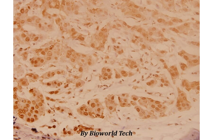 Anti-JNK1/2/3 (Y185) Antibody from Bioworld Technology (BS3631) - Antibodies.com