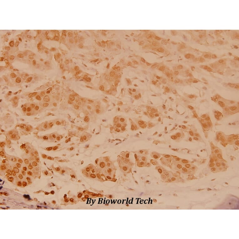 Anti-JNK1/2/3 (Y185) Antibody from Bioworld Technology (BS3631) - Antibodies.com