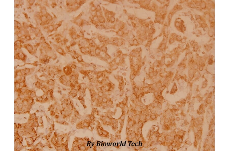 Anti-NFkB-p105 (D926) Antibody from Bioworld Technology (BS3632) - Antibodies.com