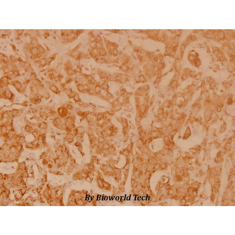 Anti-NFkB-p105 (D926) Antibody from Bioworld Technology (BS3632) - Antibodies.com