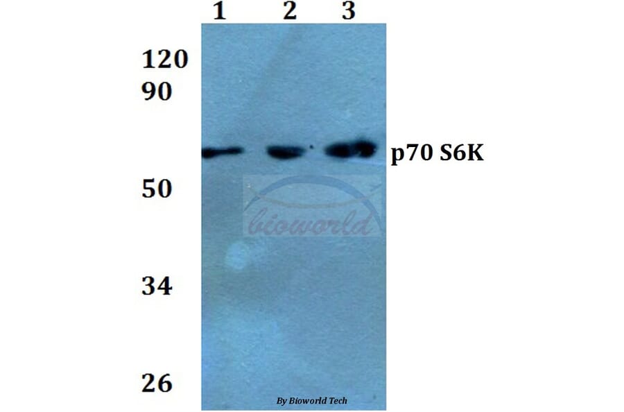 Anti-p70 S6K (F428) Antibody from Bioworld Technology (BS3633) - Antibodies.com