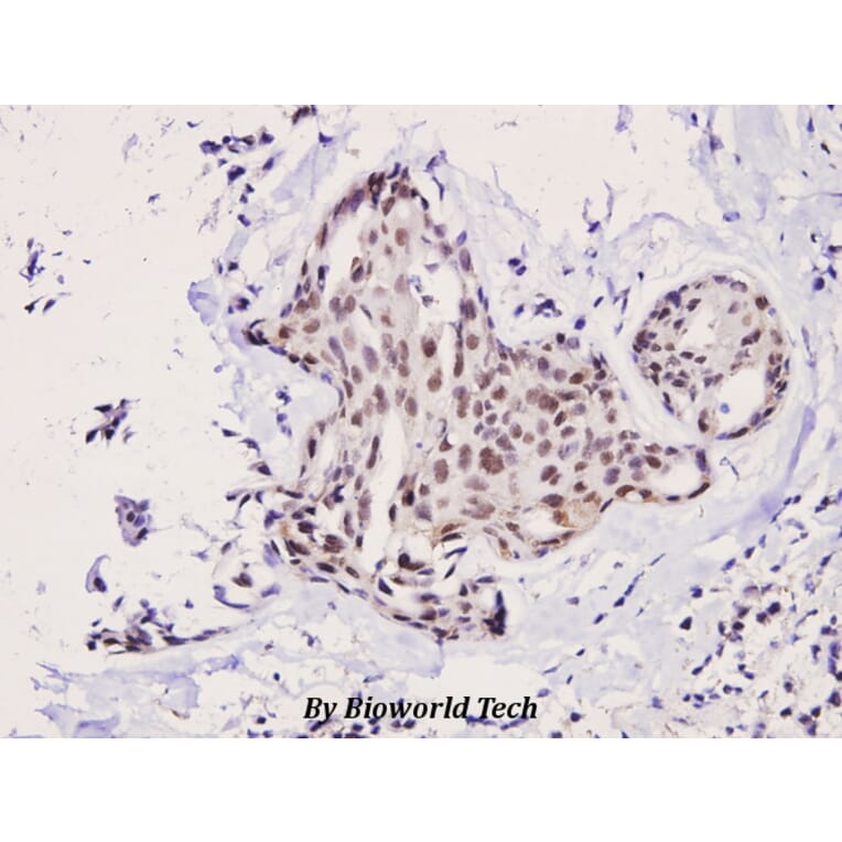 Anti-p70 S6K (F428) Antibody from Bioworld Technology (BS3633) - Antibodies.com