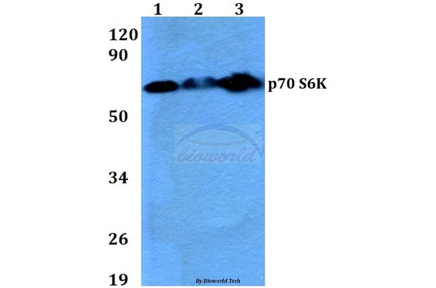 Anti-p70 S6K (F438) Antibody from Bioworld Technology (BS3634) - Antibodies.com