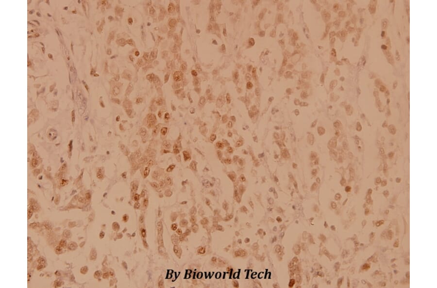 Anti-p70 S6K (F438) Antibody from Bioworld Technology (BS3634) - Antibodies.com