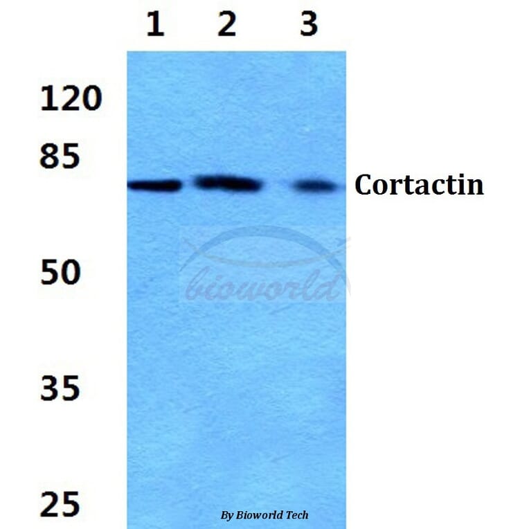 Anti-Cortactin (P415) Antibody from Bioworld Technology (BS3641) - Antibodies.com