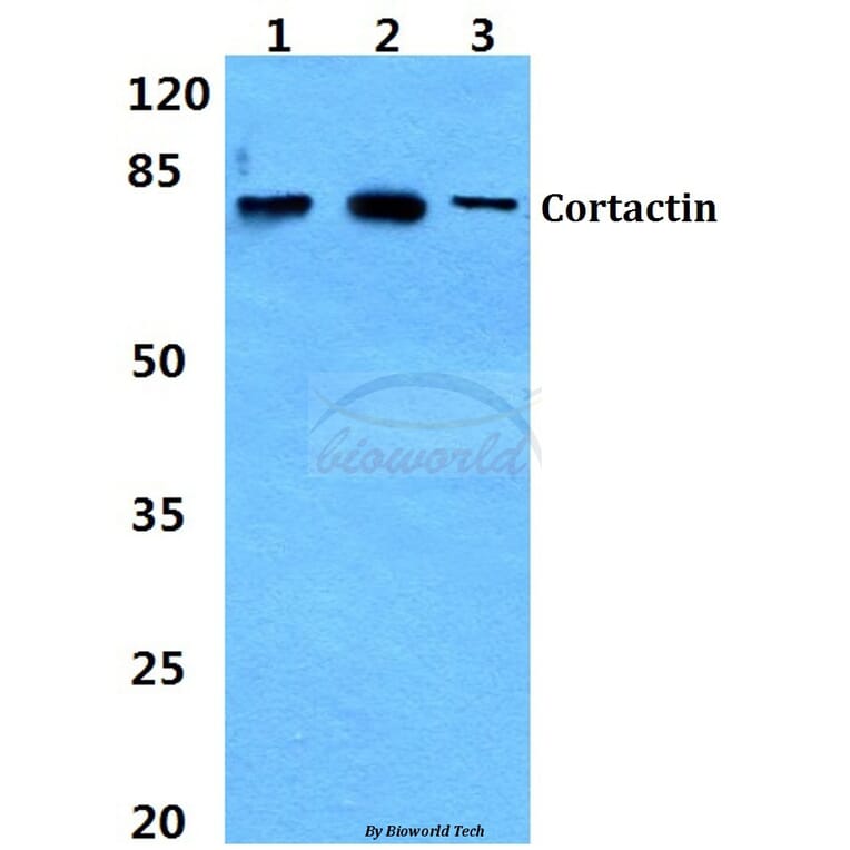 Anti-Cortactin (Y460) Antibody from Bioworld Technology (BS3642) - Antibodies.com