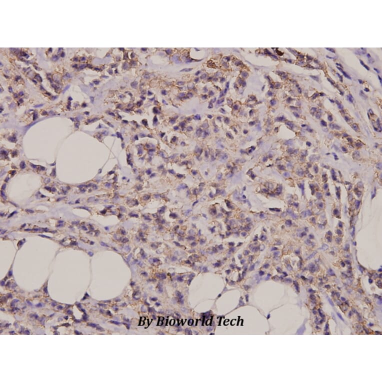 Anti-Cortactin (Y460) Antibody from Bioworld Technology (BS3642) - Antibodies.com