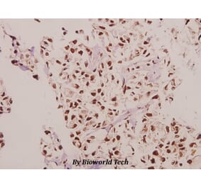 Anti-CPI-17 (K32) Antibody from Bioworld Technology (BS3643) - Antibodies.com