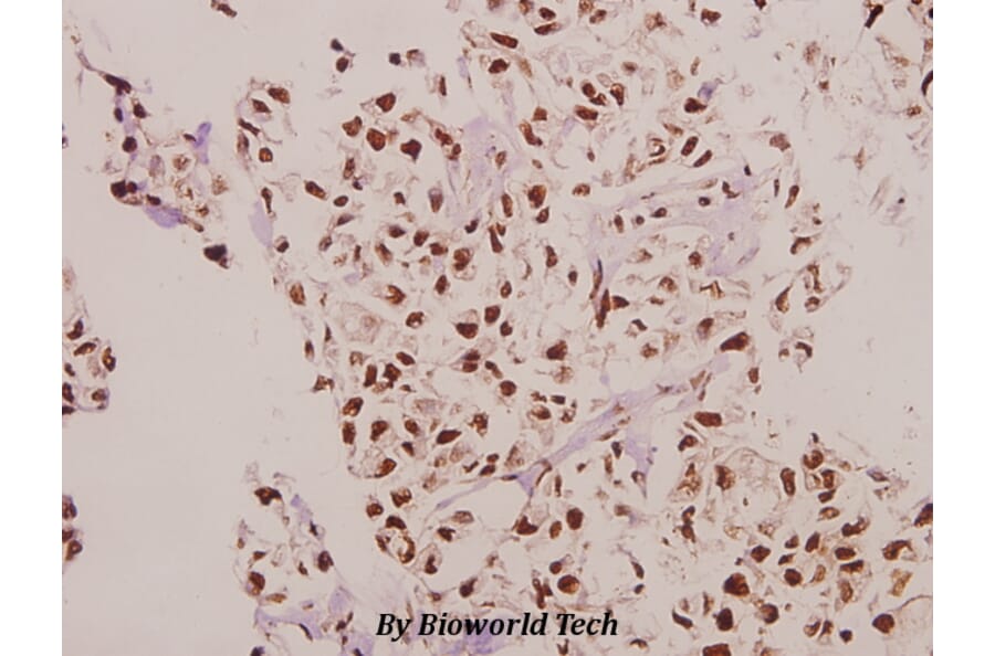 Anti-CPI-17 (K32) Antibody from Bioworld Technology (BS3643) - Antibodies.com