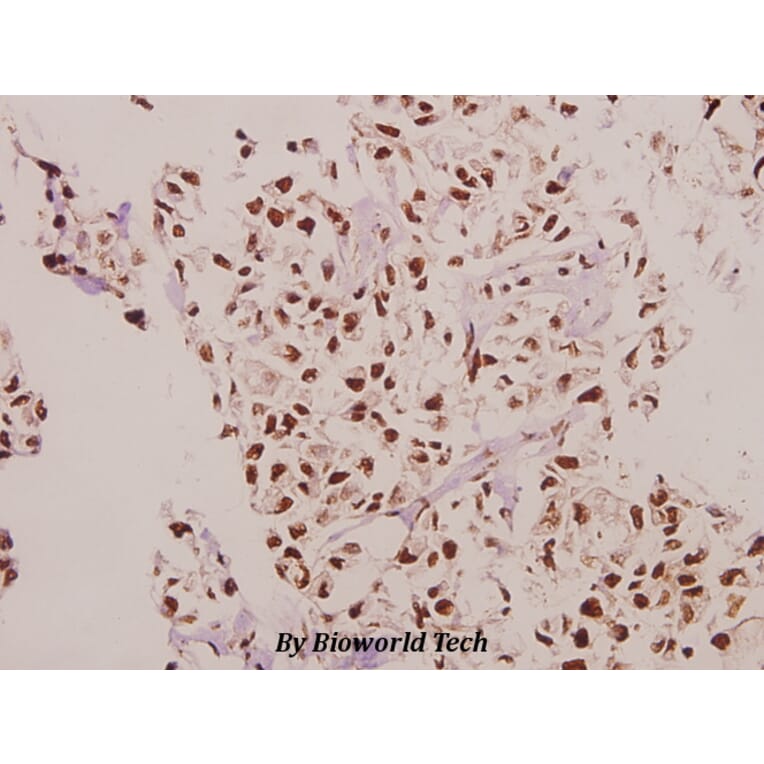 Anti-CPI-17 (K32) Antibody from Bioworld Technology (BS3643) - Antibodies.com