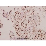 Anti-CPI-17 (K32) Antibody from Bioworld Technology (BS3643) - Antibodies.com