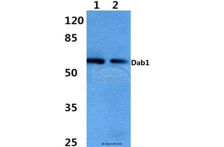 Anti-Dab1 (E214) Antibody from Bioworld Technology (BS3645) - Antibodies.com