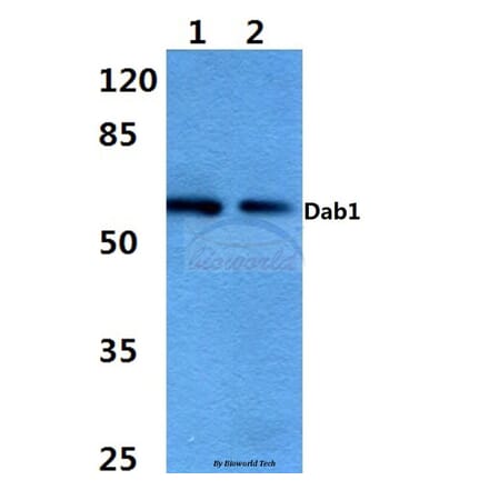 Anti-Dab1 (E214) Antibody from Bioworld Technology (BS3645) - Antibodies.com