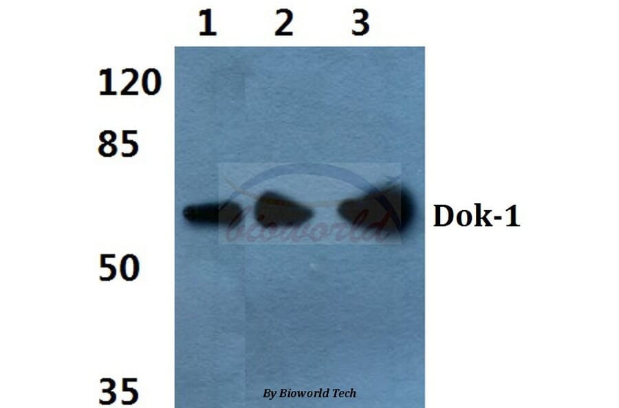 Anti-Dok-1 (P356) Antibody from Bioworld Technology (BS3649) - Antibodies.com