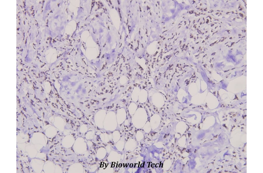 Anti-Dok-1 (P356) Antibody from Bioworld Technology (BS3649) - Antibodies.com