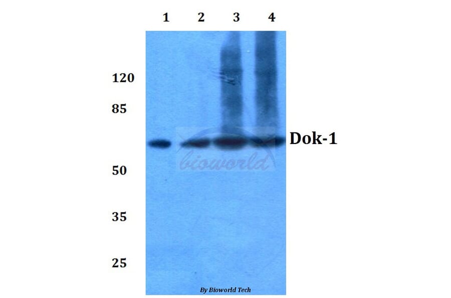 Anti-Dok-1 (R392) Antibody from Bioworld Technology (BS3650) - Antibodies.com