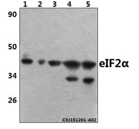 Anti-eIF2α (I45) Antibody from Bioworld Technology (BS3651) - Antibodies.com