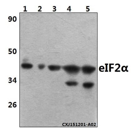 Anti-eIF2α (I45) Antibody from Bioworld Technology (BS3651) - Antibodies.com