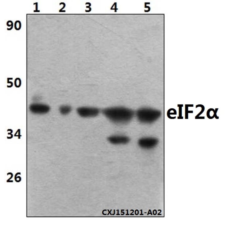 Anti-eIF2α (I45) Antibody from Bioworld Technology (BS3651) - Antibodies.com