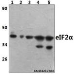 Anti-eIF2α (I45) Antibody from Bioworld Technology (BS3651) - Antibodies.com