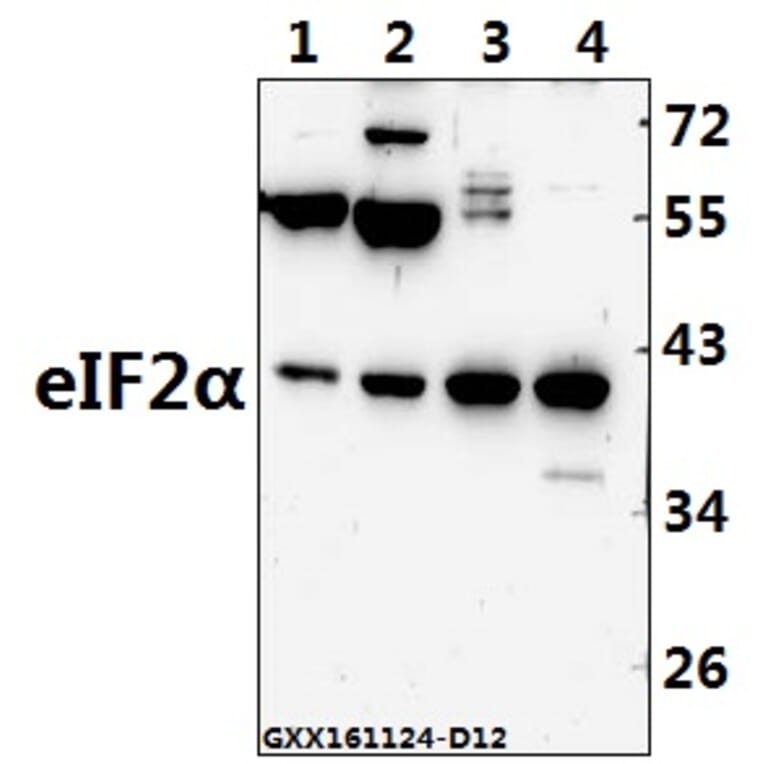 Anti-eIF2α (I45) Antibody from Bioworld Technology (BS3651) - Antibodies.com