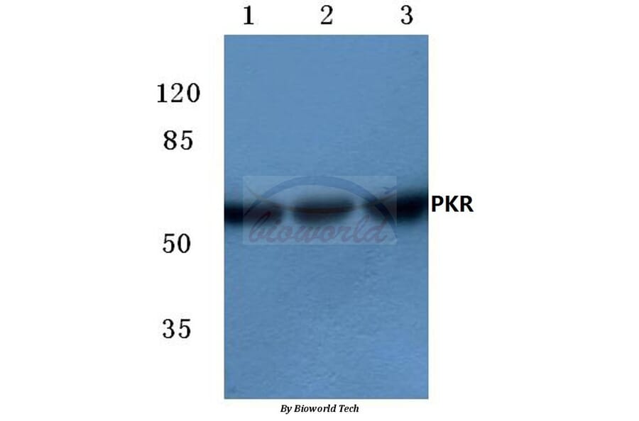 Anti-PKR (R445) Antibody from Bioworld Technology (BS3652) - Antibodies.com