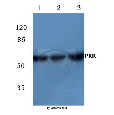 Anti-PKR (R445) Antibody from Bioworld Technology (BS3652) - Antibodies.com