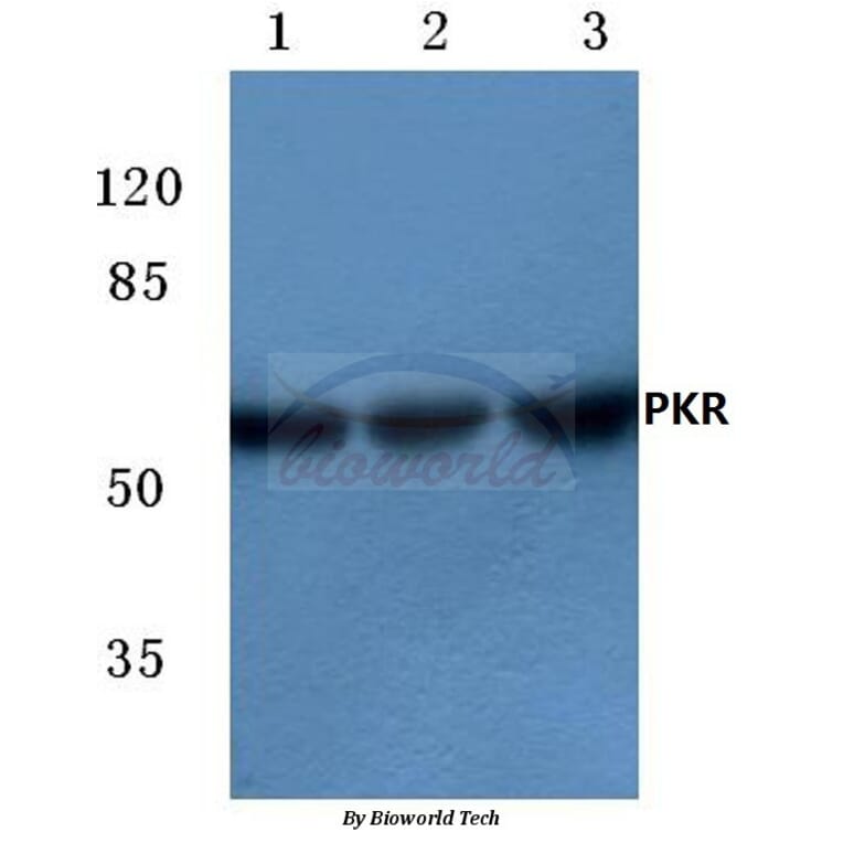 Anti-PKR (R445) Antibody from Bioworld Technology (BS3652) - Antibodies.com