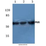 Anti-PKR (R445) Antibody from Bioworld Technology (BS3652) - Antibodies.com
