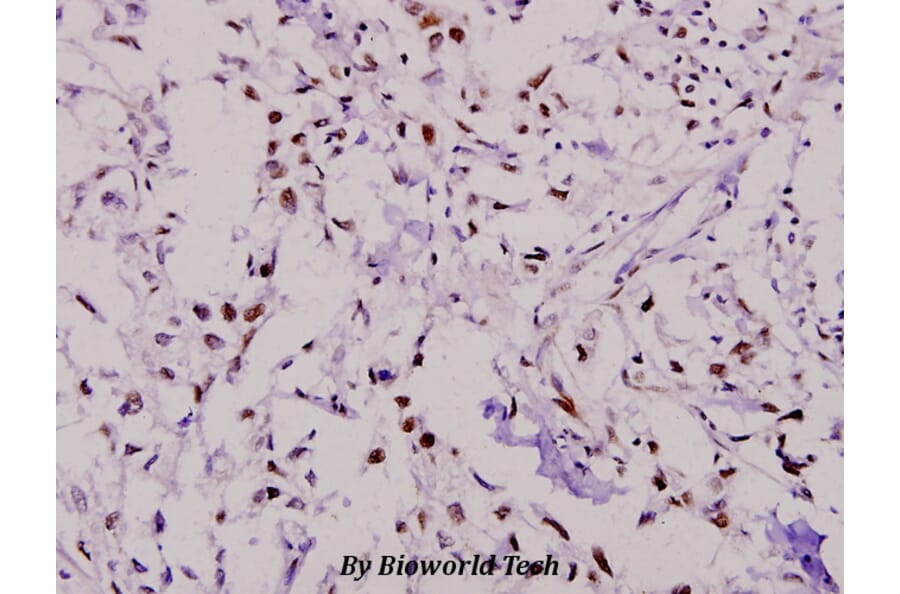 Anti-PKR (R445) Antibody from Bioworld Technology (BS3652) - Antibodies.com