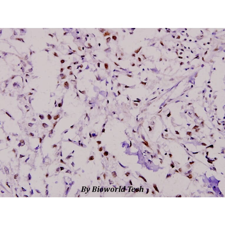 Anti-PKR (R445) Antibody from Bioworld Technology (BS3652) - Antibodies.com