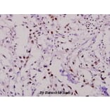 Anti-PKR (R445) Antibody from Bioworld Technology (BS3652) - Antibodies.com
