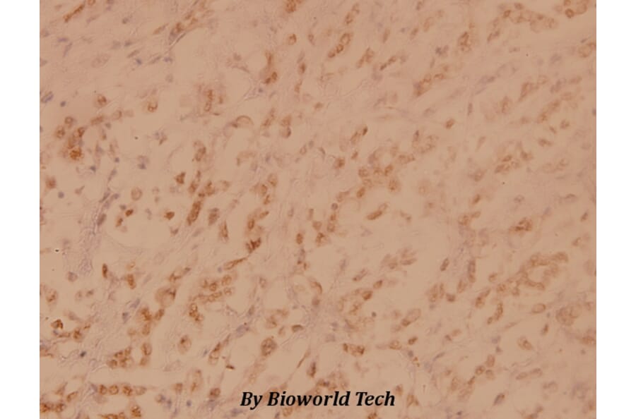 Anti-PKR (K440) Antibody from Bioworld Technology (BS3653) - Antibodies.com