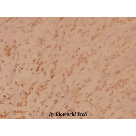 Anti-PKR (K440) Antibody from Bioworld Technology (BS3653) - Antibodies.com