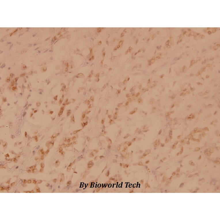 Anti-PKR (K440) Antibody from Bioworld Technology (BS3653) - Antibodies.com