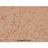 Anti-PKR (K440) Antibody from Bioworld Technology (BS3653) - Antibodies.com