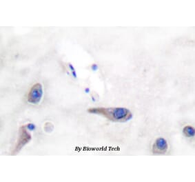 Anti-MARCKS (R157) Antibody from Bioworld Technology (BS3661) - Antibodies.com