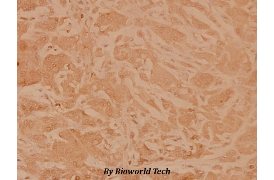 Anti-MEK1 (T286) Antibody from Bioworld Technology (BS3662) - Antibodies.com