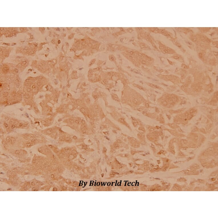 Anti-MEK1 (T286) Antibody from Bioworld Technology (BS3662) - Antibodies.com