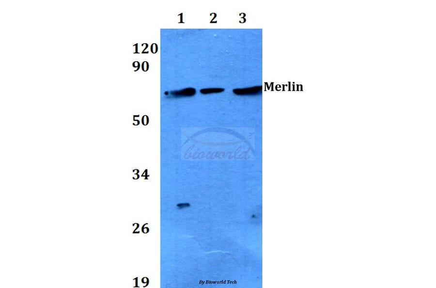 Anti-Merlin (T512) Antibody from Bioworld Technology (BS3663) - Antibodies.com
