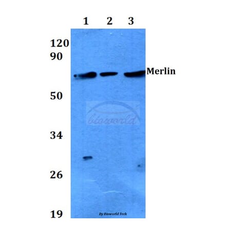 Anti-Merlin (T512) Antibody from Bioworld Technology (BS3663) - Antibodies.com