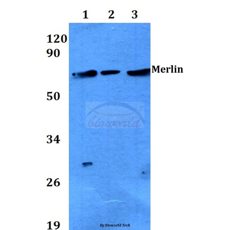 Anti-Merlin (T512) Antibody from Bioworld Technology (BS3663) - Antibodies.com