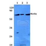 Anti-Merlin (T512) Antibody from Bioworld Technology (BS3663) - Antibodies.com