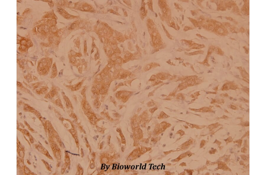 Anti-NMDAζ1 (F891) Antibody from Bioworld Technology (BS3664) - Antibodies.com