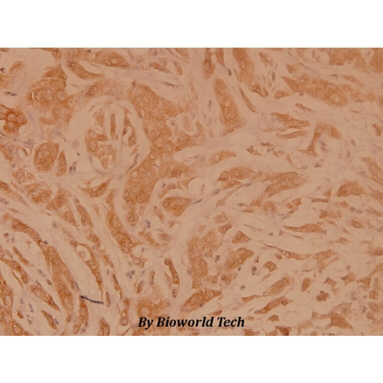 Anti-NMDAζ1 (F891) Antibody from Bioworld Technology (BS3664) - Antibodies.com