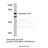 Anti-Synapsin I (Y3) Antibody from Bioworld Technology (BS3667) - Antibodies.com